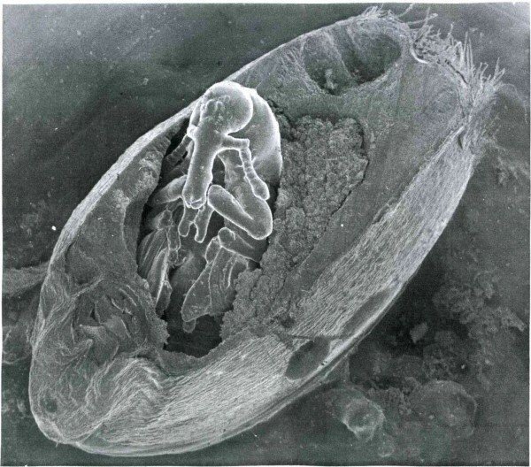 Кровь насекомых под микроскопом
